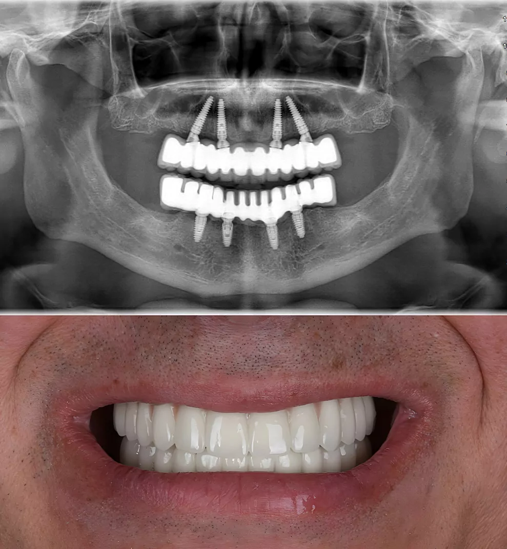Smiling patient after dental treatment